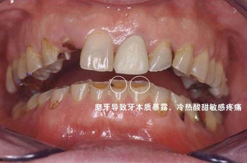 磨牙成人制作方法视频-第2张图片-草莓视频深夜