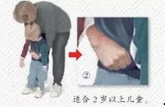 成人急救异物视频大全,成人异物窒息处理全攻略-第3张图片-草莓视频深夜